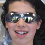 braces2
