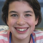 braces3