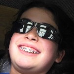 braces6